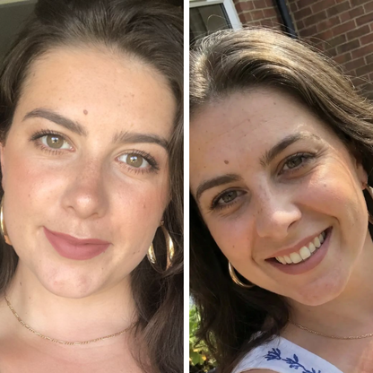 ערכת שרביט הטיפוח 4 ב-1 לחידוש העור בטכנולוגיית אור אדום