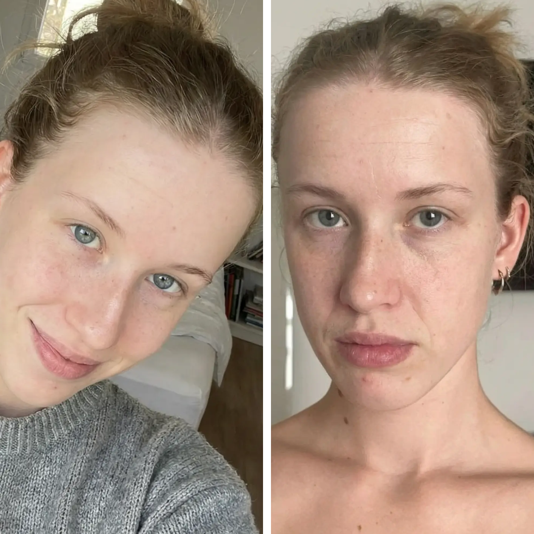 ערכת שרביט הטיפוח 4 ב-1 לחידוש העור בטכנולוגיית אור אדום