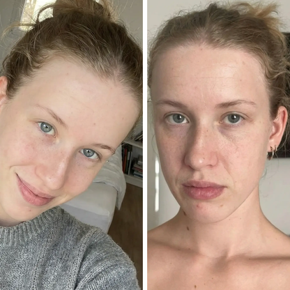 ערכת שרביט הטיפוח 4 ב-1 לחידוש העור בטכנולוגיית אור אדום